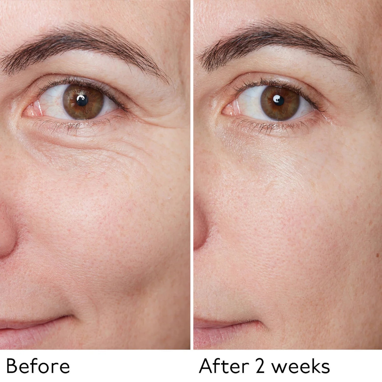 Hyaluronic Global Serum 30ml