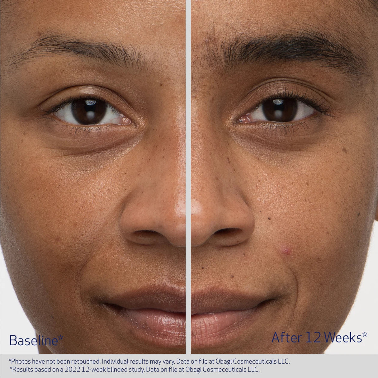 Nu-Cil Eyebrow Boosting Serum 5ml