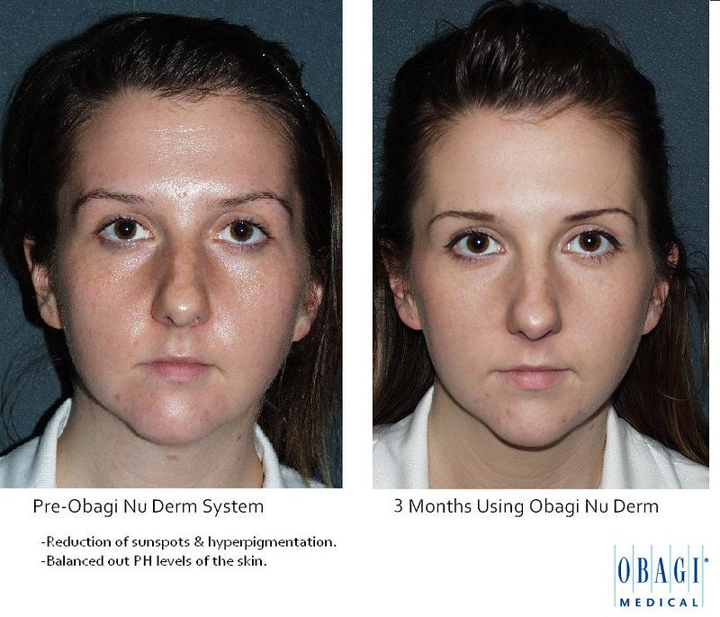 Obagi Complete Skin Transformation Kit