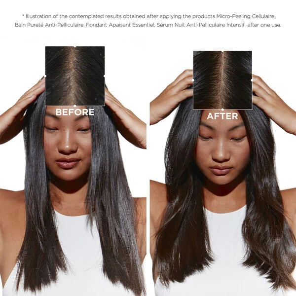 Symbiosis Bain Creme Anti-Pellular shampoo