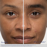 Nu-Cil Eyebrow Boosting Serum 5ml