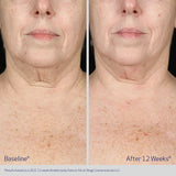 ELASTIderm Neck & Décolleté Concentrate 60ml