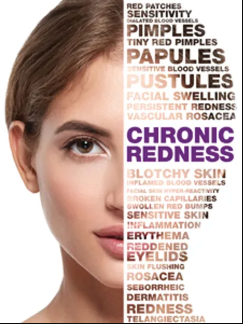 cr recovery, sensitiv, rosacea